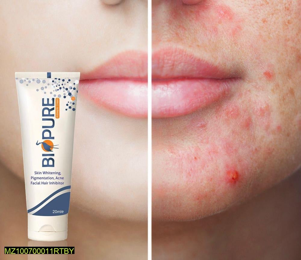 Biopure Acne cream